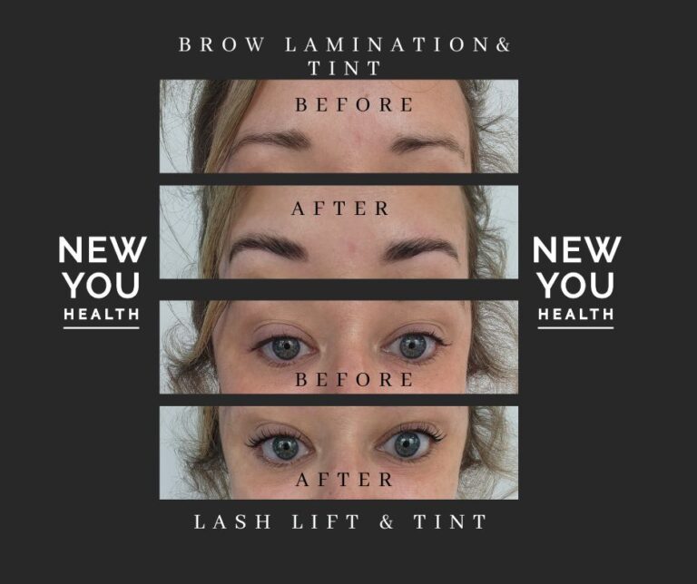 Image show two before and after images one labeled as "before, the other as "after". The top photo shows eyebrows after a brow lamination tint. They are noticeably darker and fuller in the after photo. The second set shows a before and after of a lash lift and tint. The eyelashes appear darker and more full in the after photo