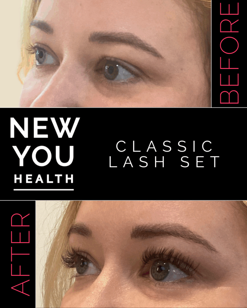 Before and after results of professional aesthetic treatments including lash lifts, brow waxing, brow lamination, brow tinting, and eyelash extensions. The image showcases fuller, lifted lashes and sculpted, tinted brows for a clean, polished look. Perfect for highlighting the transformative power of lash and brow services at New You Health in Peoria, IL, designed to enhance natural beauty with low-maintenance, long-lasting results.