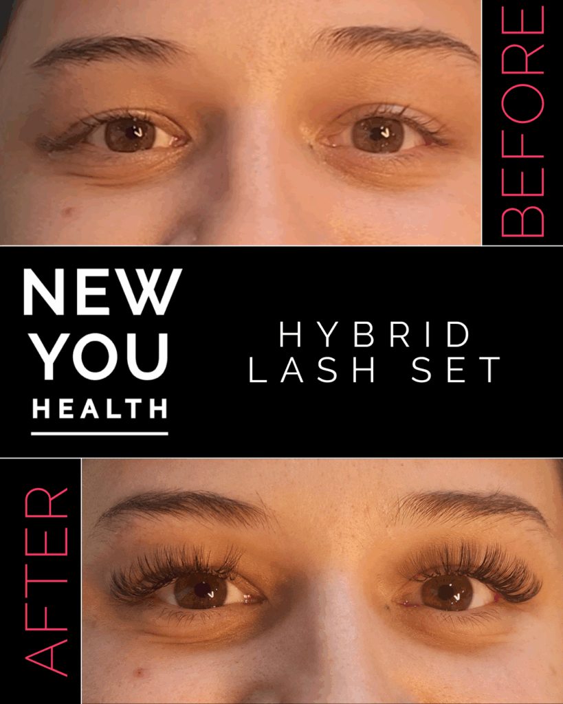 Before and after results of professional aesthetic treatments including lash lifts, brow waxing, brow lamination, brow tinting, and eyelash extensions. The image showcases fuller, lifted lashes and sculpted, tinted brows for a clean, polished look. Perfect for highlighting the transformative power of lash and brow services at New You Health in Peoria, IL, designed to enhance natural beauty with low-maintenance, long-lasting results.