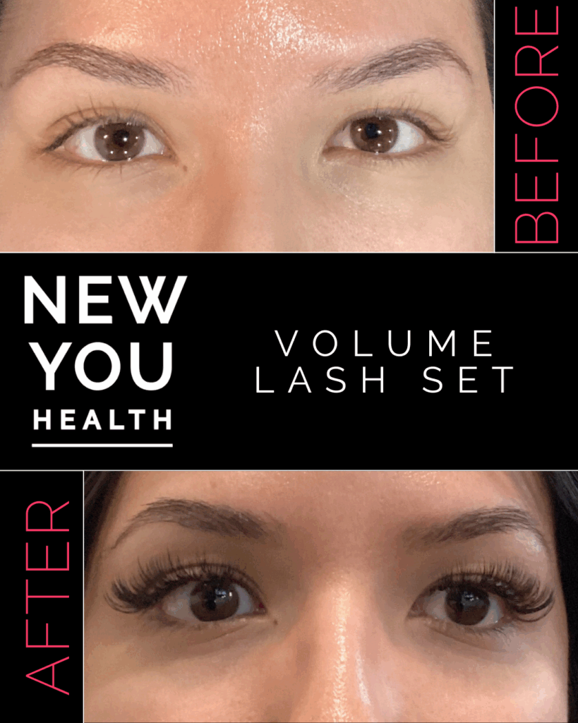 Before and after results of professional aesthetic treatments including lash lifts, brow waxing, brow lamination, brow tinting, and eyelash extensions. The image showcases fuller, lifted lashes and sculpted, tinted brows for a clean, polished look. Perfect for highlighting the transformative power of lash and brow services at New You Health in Peoria, IL, designed to enhance natural beauty with low-maintenance, long-lasting results.