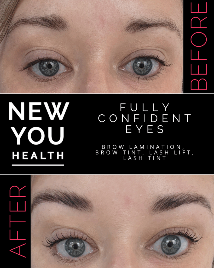 Before and after results of professional aesthetic treatments including lash lifts, brow waxing, brow lamination, brow tinting, and eyelash extensions. The image showcases fuller, lifted lashes and sculpted, tinted brows for a clean, polished look. Perfect for highlighting the transformative power of lash and brow services at New You Health in Peoria, IL, designed to enhance natural beauty with low-maintenance, long-lasting results.