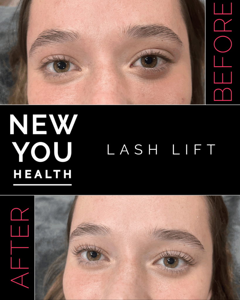 Before and after results of professional aesthetic treatments including lash lifts, brow waxing, brow lamination, brow tinting, and eyelash extensions. The image showcases fuller, lifted lashes and sculpted, tinted brows for a clean, polished look. Perfect for highlighting the transformative power of lash and brow services at New You Health in Peoria, IL, designed to enhance natural beauty with low-maintenance, long-lasting results.