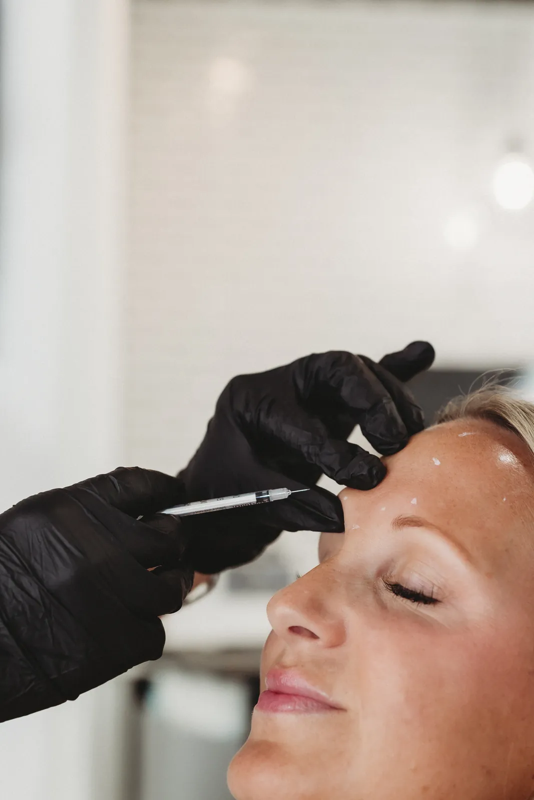 Close-up of a Botox injection with mapped injection points on the forehead at New You Health in Peoria, IL